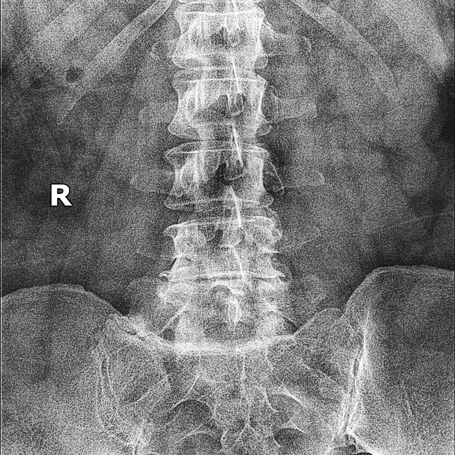 You are currently viewing Eliminate Up To 95% Of Your Neck And Back Pain!
